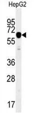 IGF2BP2 (C-term) Rabbit Polyclonal Antibody - image 1