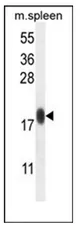 IMMP1L (C-term) Rabbit Polyclonal Antibody - image 1