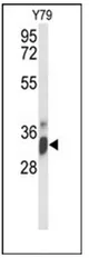 IMP4 (C-term) Rabbit Polyclonal Antibody - image 1