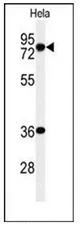 INTS10 (C-term) Rabbit Polyclonal Antibody - image 1