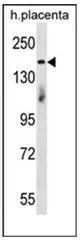 INTS1 (N-term) Rabbit Polyclonal Antibody - image 1