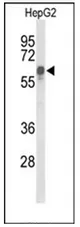 IP3KC (ITPKC) (N-term) Rabbit Polyclonal Antibody - image 1