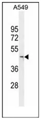 JMJD5 (KDM8) (N-term) Rabbit Polyclonal Antibody - image 1
