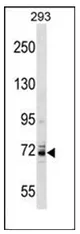 KCNC4 (C-term) Rabbit Polyclonal Antibody - image 1