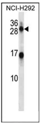 Kallikrein 14 (KLK14) (N-term) Rabbit Polyclonal Antibody - image 1