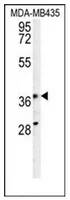 PRPSAP1 (N-term) Rabbit Polyclonal Antibody - image 1