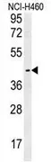 LAPTM5 (N-term) Rabbit Polyclonal Antibody - image 1
