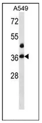 LASP1 (Center) Rabbit Polyclonal Antibody - image 1