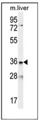 LDLRAD3 (C-term) Rabbit Polyclonal Antibody - image 1