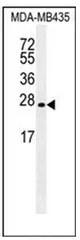 Lin28 (LIN28A) Rabbit Polyclonal Antibody - image 1