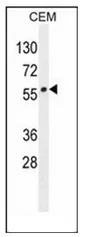 LIPC (N-term) Rabbit Polyclonal Antibody - image 1