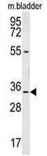 LRRC18 (C-term) Rabbit Polyclonal Antibody - image 1