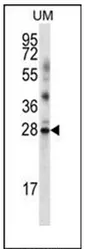 LRRN4CL (Center) Rabbit Polyclonal Antibody - image 1