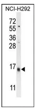 LY6G6C (C-term) Rabbit Polyclonal Antibody - image 1