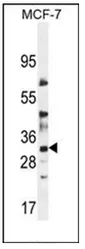 LYSMD4 (N-term) Rabbit Polyclonal Antibody - image 1