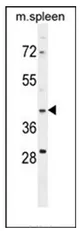 MAP1D (METAP1D) (N-term) Rabbit Polyclonal Antibody - image 1