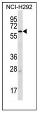 S2P (MBTPS2) (N-term) Rabbit Polyclonal Antibody - image 1