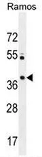 PRR22 (C-term) Rabbit Polyclonal Antibody - image 1