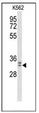 Morg1 (WDR83) (Center) Rabbit Polyclonal Antibody - image 1