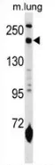 Mannose Receptor (MRC1) (N-term) Rabbit Polyclonal Antibody - image 1