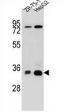 MTHFD2 (MTHFD2L) (C-term) Rabbit Polyclonal Antibody - image 1
