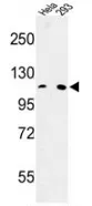 MTTP (C-term) Rabbit Polyclonal Antibody - image 1