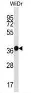 MUC15 (C-term) Rabbit Polyclonal Antibody - image 1