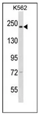 hCAP D3 (NCAPD3) (C-term) Rabbit Polyclonal Antibody - image 1