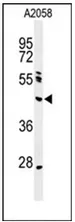 NEIL1 (Center) Rabbit Polyclonal Antibody - image 1