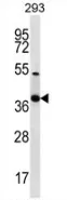 Nkx2.2 (NKX2-2) (Center) Rabbit Polyclonal Antibody - image 1