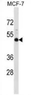 NMBR (N-term) Rabbit Polyclonal Antibody - image 1