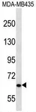 NPHP3 (N-term) Rabbit Polyclonal Antibody - image 1