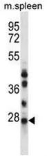 NQO2 (N-term) Rabbit Polyclonal Antibody - image 1