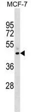 NR2F6 (N-term) Rabbit Polyclonal Antibody - image 1