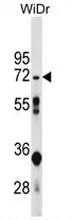 NT5C2 (N-term) Rabbit Polyclonal Antibody - image 1