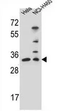 NTH1 (NTHL1) (Center) Rabbit Polyclonal Antibody - image 1