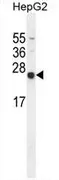 NUDT15 (C-term) Rabbit Polyclonal Antibody - image 1