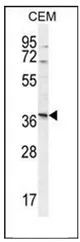 NXPH4 (C-term) Rabbit Polyclonal Antibody - image 1