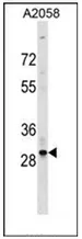 OR4F17 (N-term) Rabbit Polyclonal Antibody - image 1