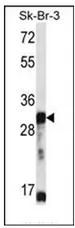 OR5D13 (Center) Rabbit Polyclonal Antibody - image 1