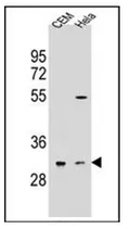 OR5L2 (N-term) Rabbit Polyclonal Antibody - image 1