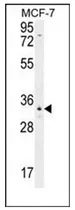 OR6C4 (C-term) Rabbit Polyclonal Antibody - image 1