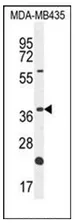 OR6V1 (C-term) Rabbit Polyclonal Antibody - image 1