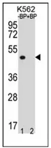 OR8K3 (C-term) Rabbit Polyclonal Antibody - image 1