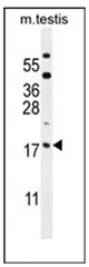 ORMDL3 (Center) Rabbit Polyclonal Antibody - image 1
