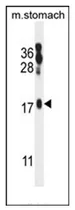 ORMDL2 (Center) Rabbit Polyclonal Antibody - image 1