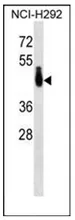 PABPC4L (C-term) Rabbit Polyclonal Antibody - image 1