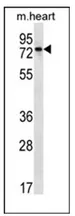 Parp2 (C-term) Rabbit Polyclonal Antibody - image 1