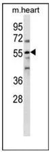 Parp2 (N-term) Rabbit Polyclonal Antibody - image 1