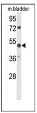 Parvin alpha (PARVA) (C-term) Rabbit Polyclonal Antibody - image 1